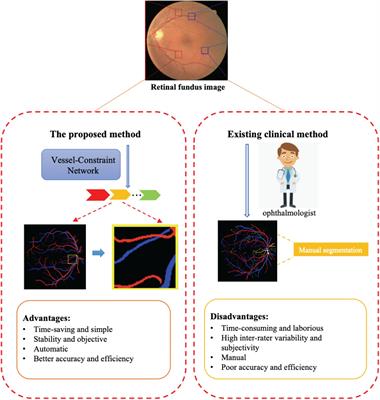 Automatic Artery/Vein Classification Using a Vessel-Constraint Network for Multicenter Fundus Images